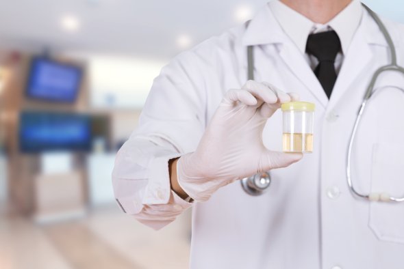 Ist Cbd Beim Drogentest Nachweisbar